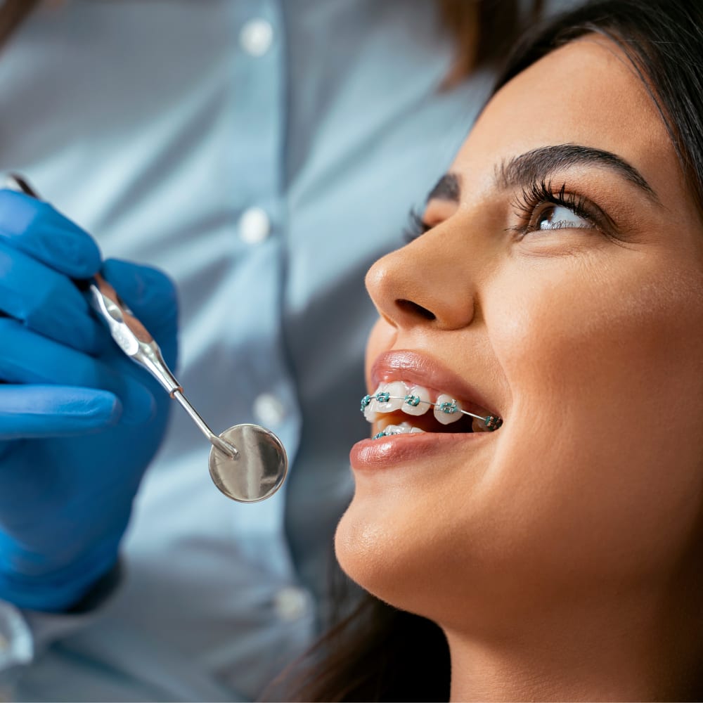 A woman with braces smiles as a team member holds their mouth mirror tool.