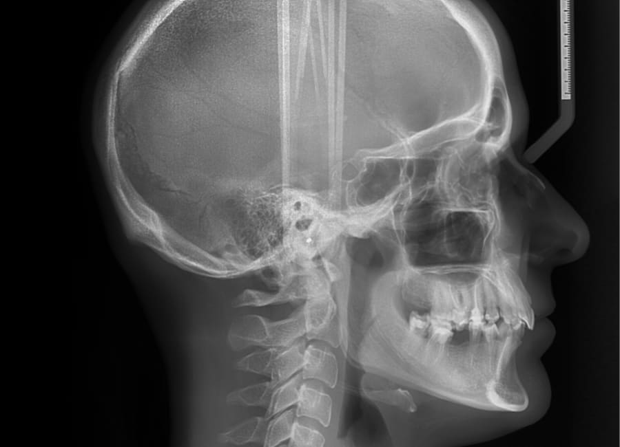 An example of a cephalometric X-ray.