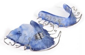 The Importance of Wearing Your Retainers Post-Braces