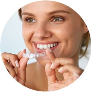 The Invisalign Process — Step-by-Step